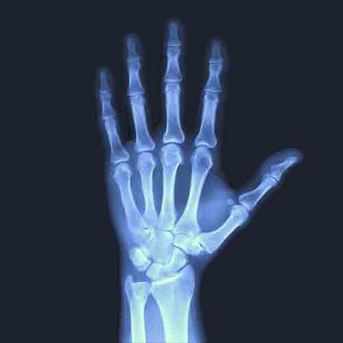 x-ray